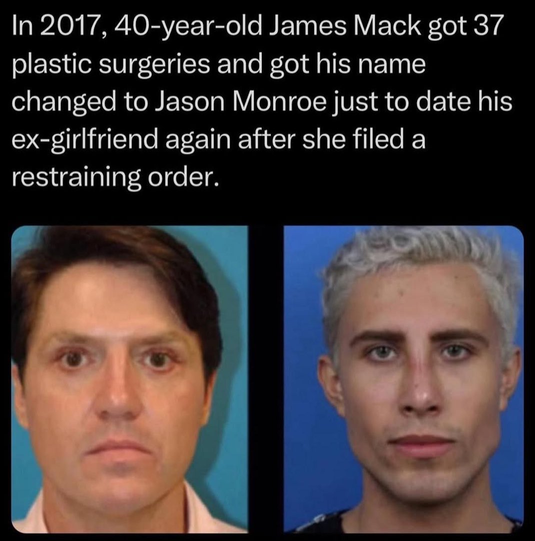 Man got 37 plastic surgeries to trick ex girlfriend into dating him again.