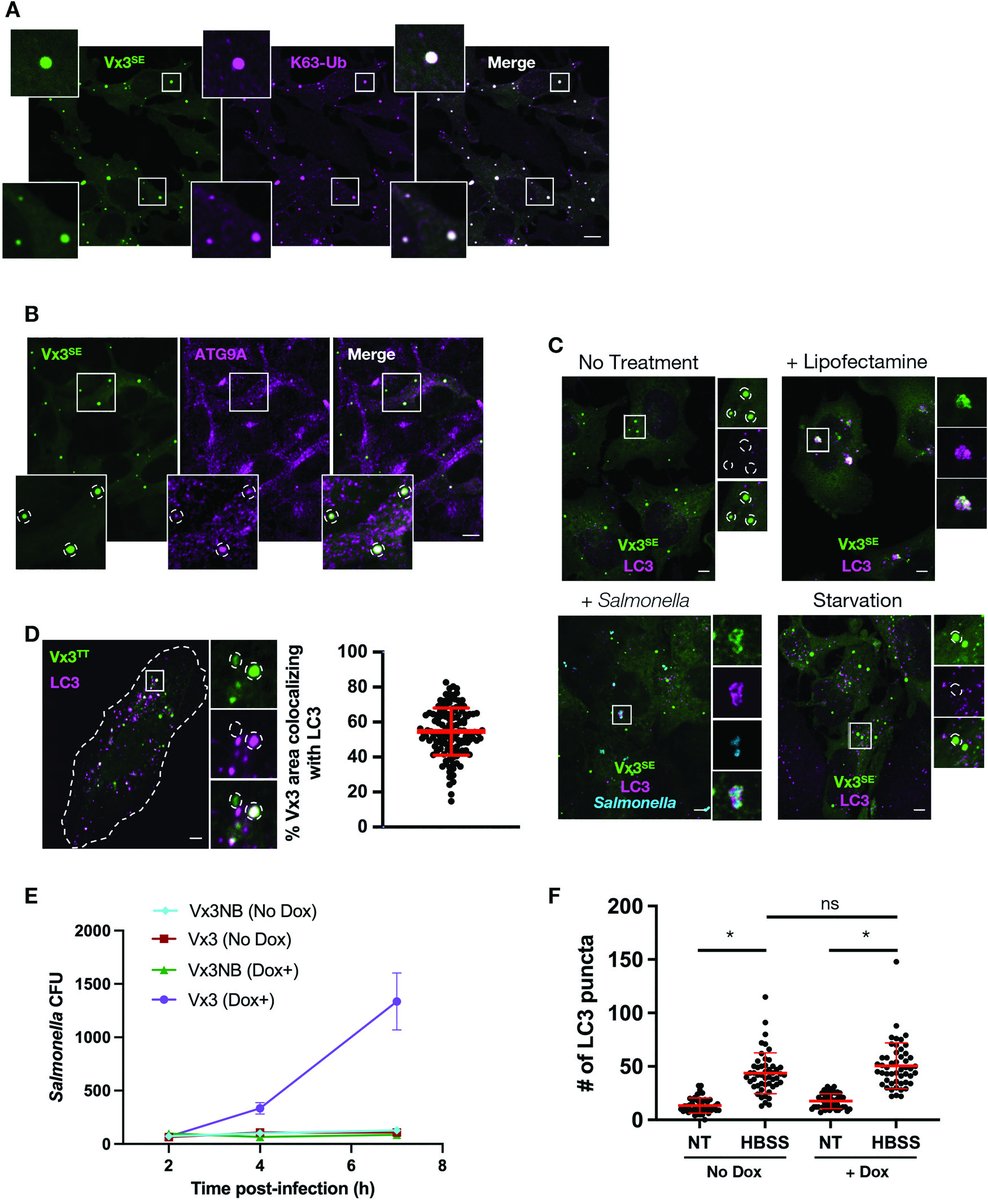 American Society for Cell Biology (@ascbiology) on Twitter photo From MBoC... <a href="/scafrancesco1/">Francesco Scavone</a> (Stanford) shows ATG9A has an unexpected role in trafficking K63-polyubiquitin–modified membrane proteins. Blocking the signal traps cargos in vesicle clusters; once released, they rapidly reach lysosomes. 🔗 molbiolcell.org/doi/10.1091/mb… #ASCB #CellBiology From MBoC... <a href="/scafrancesco1/">Francesco Scavone</a> (Stanford) shows ATG9A has an unexpected role in trafficking K63-polyubiquitin–modified membrane proteins. Blocking the signal traps cargos in vesicle clusters; once released, they rapidly reach lysosomes. 🔗 molbiolcell.org/doi/10.1091/mb… #ASCB #CellBiology