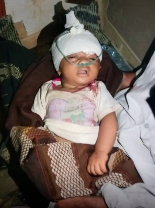 ارتقاء الطفل الرضيع زيد البالغ من العمر  (4 أشهر) شهيدا  متأثراً بإصابته البليغة بشظية صاروخ جراد أطلقته مليشيا الحوثي على منزلهم في مديرية مقبنة غرب محافظة تعز.
#الحوثي_عدو_اليمنيين