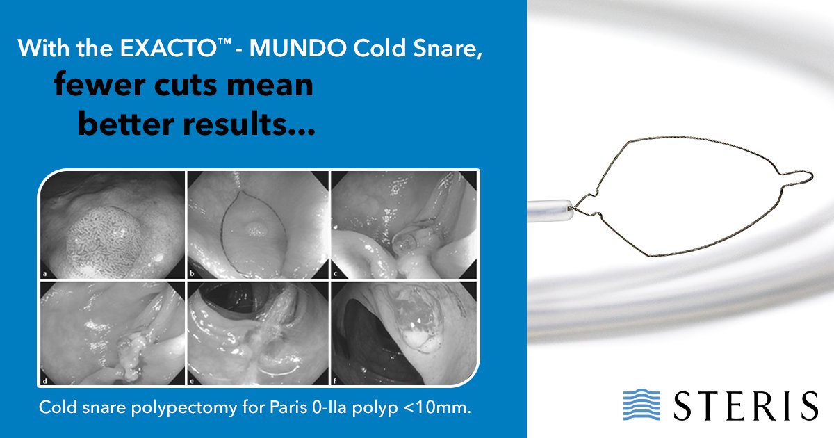 STERIS Endoscopy (@sterisendoscopy) on Twitter photo Why does snare size matter? Because every resection counts. 
That’s where the EXACTO™ - MUNDO Cold Snare comes in. It features a 14mm loop—giving you more surface area to capture and remove tissue in fewer passes. Fewer resections = lower risk of leaving tissue 
behind. 
A Why does snare size matter? Because every resection counts. 
That’s where the EXACTO™ - MUNDO Cold Snare comes in. It features a 14mm loop—giving you more surface area to capture and remove tissue in fewer passes. Fewer resections = lower risk of leaving tissue 
behind. 
A