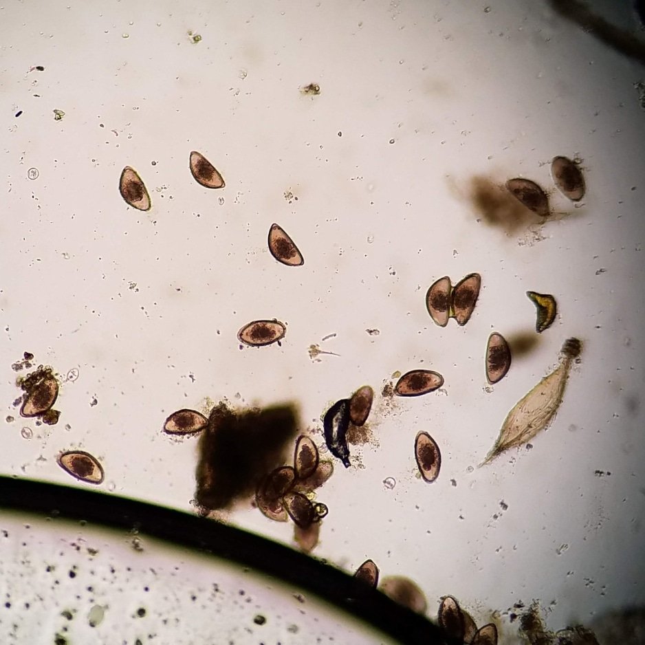 Vet_Parasites's tweet image. Pinworm (Oxyurida) egg from a bearded dragon fecal. Do you notice any other coccidian parasites in this slide? Pinworms are the most common parasite I see in reptiles. These nematodes infect the large intestines, where adult females can lay hundreds of eggs #parasitology #vettech