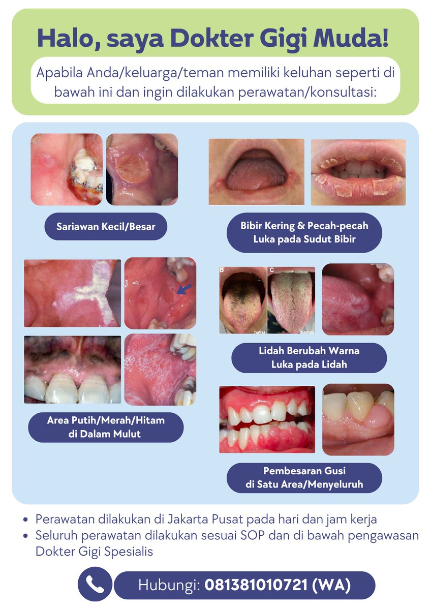 nlndiva's tweet photo. Haloo, bagi yang punya keluhan
🦷 Sariawan
🦷 Bibir luka/kering
🦷 Area putih/merah/hitam di mulut
🦷 Lidah luka/berubah warna
🦷 Pembesaran gusi
dan ingin dirawat/konsul, boleh hubungi aku yaa✨

#caripasienkoasgigi #koasgigi #perawatangigigratis #koasgigijakarta #caripasiengigi https://t.co/57cAJHKIlq