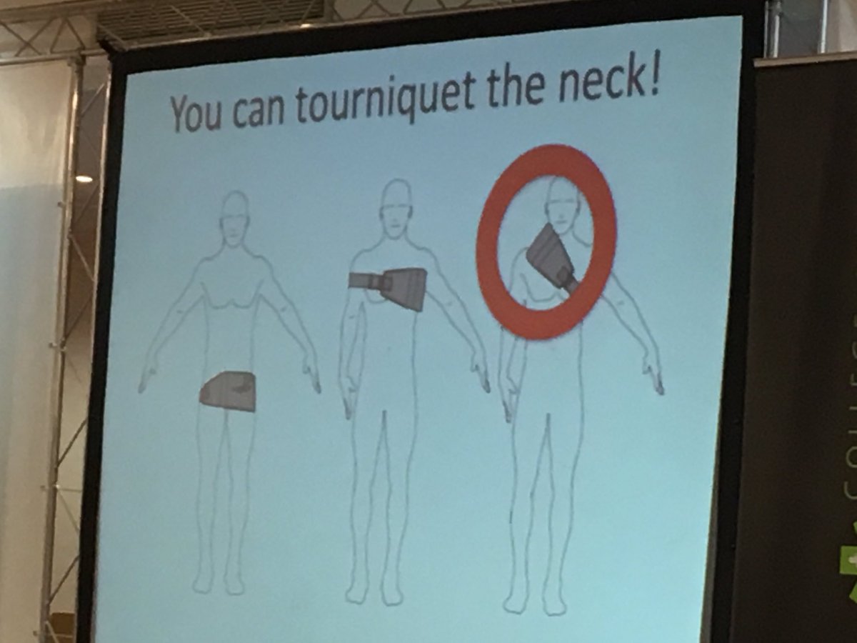 Gordie is gone man good luck. RIP C.K... No such thing as a neck tourniquet. I haven't seen a picture yet 
 of the bullet on passing through neck hitting wall or tent behind him. In my experience the non pass through is neck/head is the more lethal  kill shot.