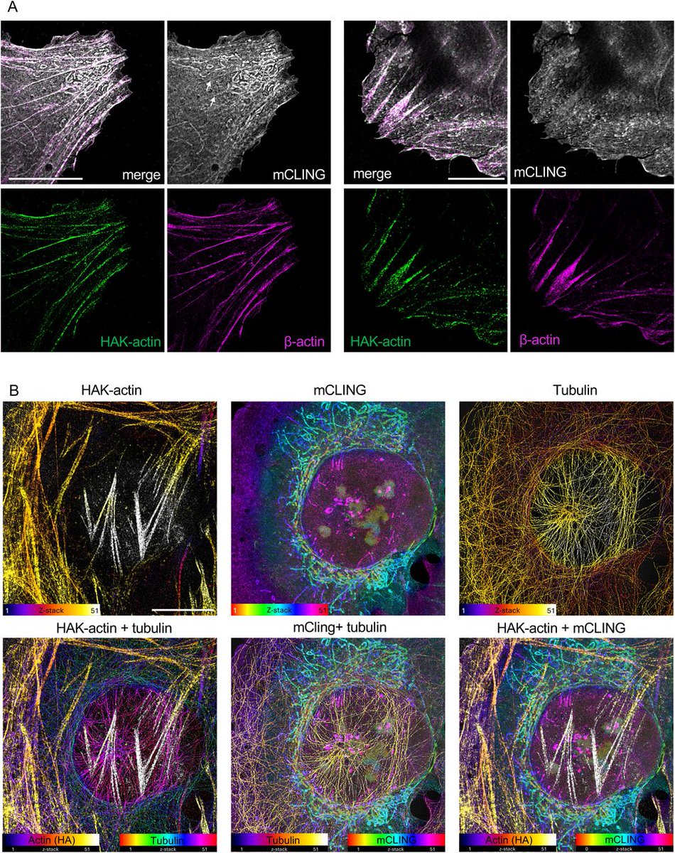 Nikon Instruments (@nikoninst) on Twitter photo 📄 🌟 Researchers introduce HAK-actin, an actin label compatible with post-labeling in #SuperResolution ultrastructure expansion #Microscopy #ExM. The authors demonstrate its use in cells expanded up to 16-fold (image).
🔗 View the preprint article: bit.ly/47xC8NJ 📄 🌟 Researchers introduce HAK-actin, an actin label compatible with post-labeling in #SuperResolution ultrastructure expansion #Microscopy #ExM. The authors demonstrate its use in cells expanded up to 16-fold (image).
🔗 View the preprint article: bit.ly/47xC8NJ