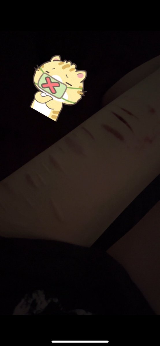 luvcreeps's tweet image. 💉#988shtwt #988twt