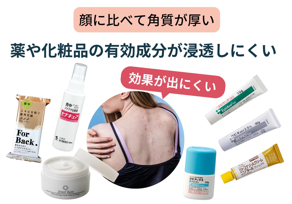 ハーブピーリング