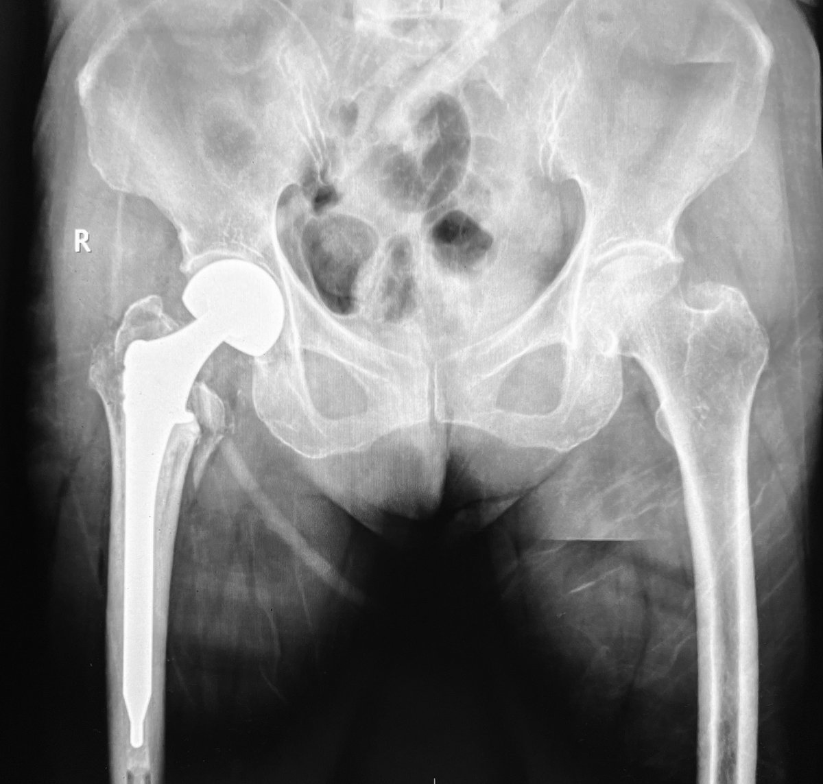 Antonio Tanchuling Jr. M.D. tweet media