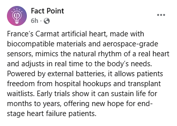 CyberpunkTTRPG's tweet image. France Unveils An Artificial Heart That Can Beat Forever With No With No Donor Needed #ArtificialHeart #HeartTransplant #BioCompatible #OrganTransplant #Cyberpunk #TTRPG #RPG