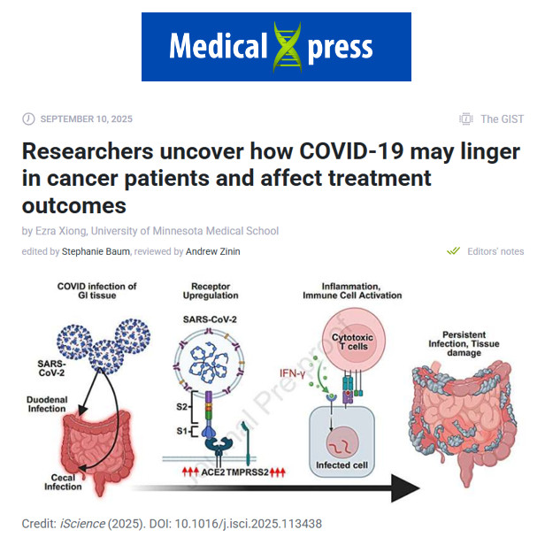 "Researchers uncover how COVID-19 may linger in cancer patients and affect treatment outcomes."

The virus lingered in the gut lining up to 6 weeks after the last positive swab sparking persistent inflammation and tissue damage that could worsen outcomes.

archive.md/hIbj4
