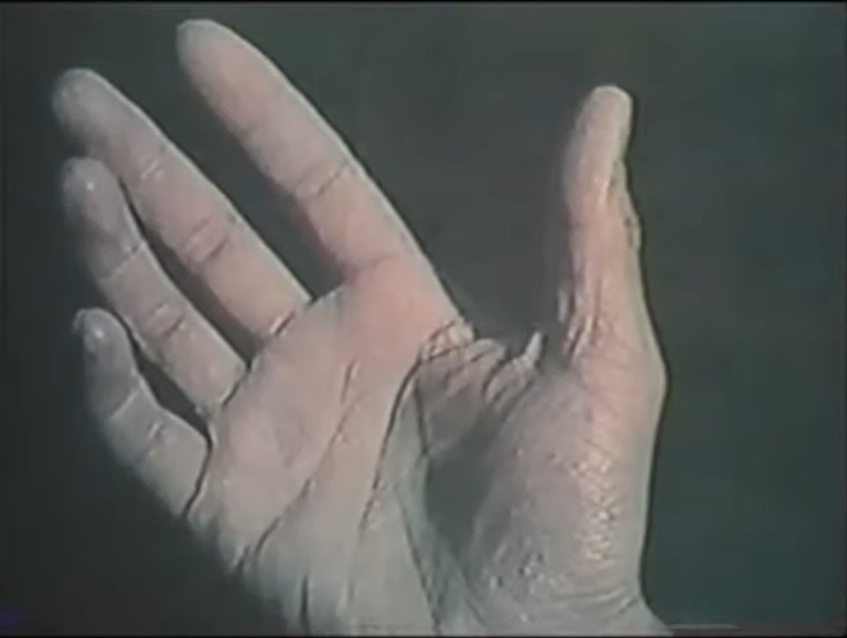 The Eraser (1977, Shuji Terayama)