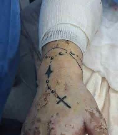 LilyIvo's tweet photo. #Explosión #pipadegas #URGENTE #cdmx 

Este paciente víctima de la explosión de hoy en el puente de la concordia, se encuentra en calidad de desconocido en el Hospital Magdalena de las Salinas  tiene un rosario tatuado en su mano, por si alguien lo reconoce avisé a sus familiar https://t.co/ZEMBs9k2T7