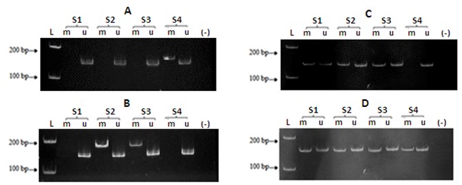 JabetEditor's tweet photo. #Aberrantmethylation of #CDKN2A, #RASSF1A and #WIF1 in sporadic adenocarcinomatous #colorectalcancer: Associations with clinicopathological features
https://t.co/Iiv4OhGV2r https://t.co/PvfUaT1mQU