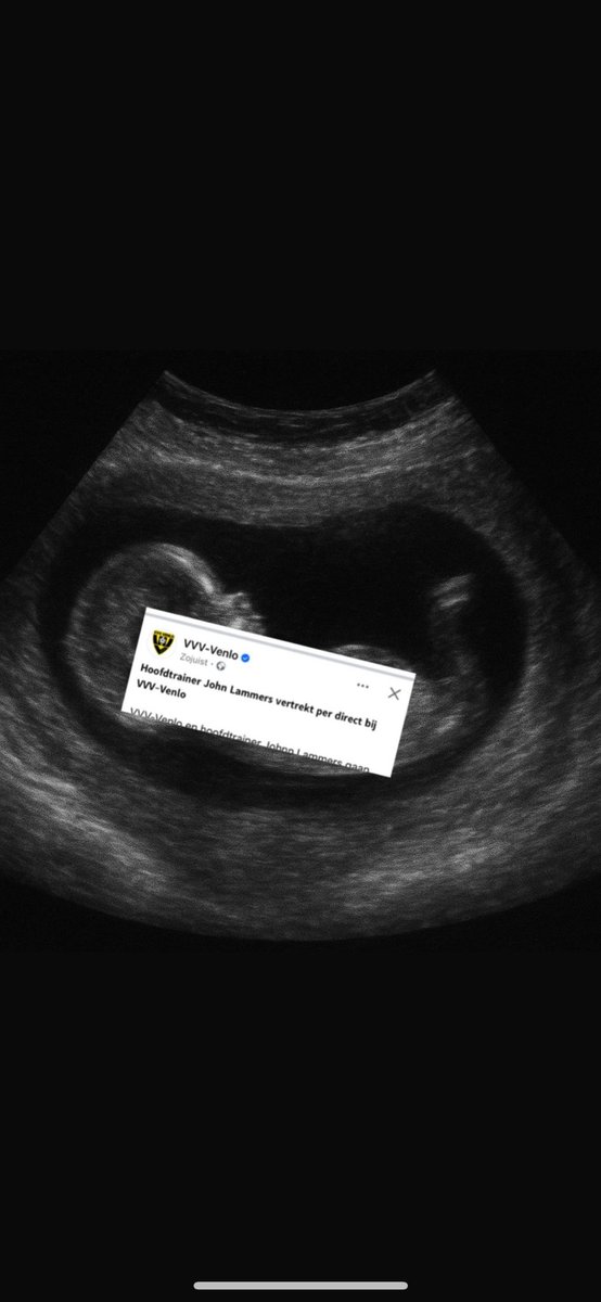 Soms komt het mooiste cadeau onverwachts… welkom lief wonder⚽️