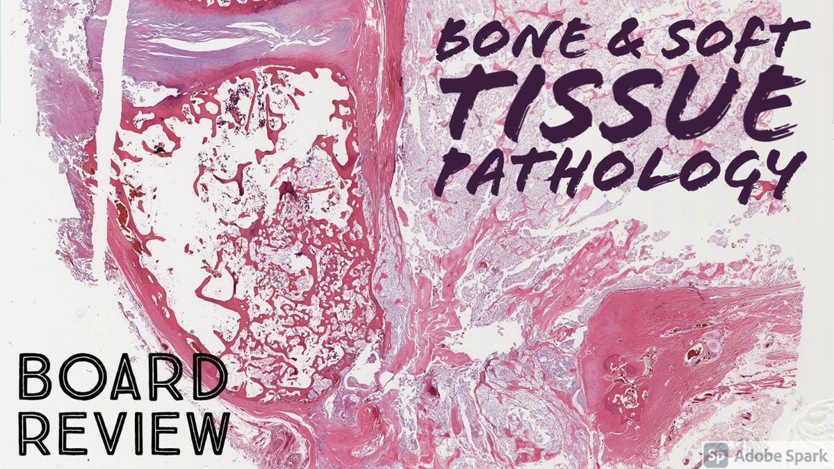 Bone &amp; Soft Tissue Pathology Board Review: 20 Classic Cases for McGill pathology residents <a href="/McgillPathRes/">McGill Pathology Residents 🔬</a>. Video: youtube.com/watch?v=raPhEE… Enjoy! 
#BSTpath #pathologists #pathology #pathTwitter