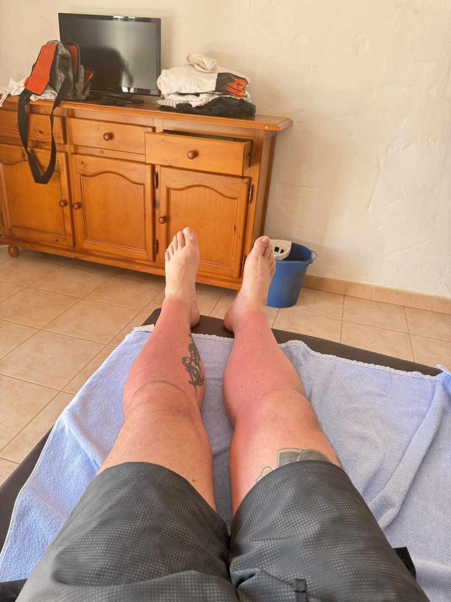 Note to self! Remove socks pre sun bathing.