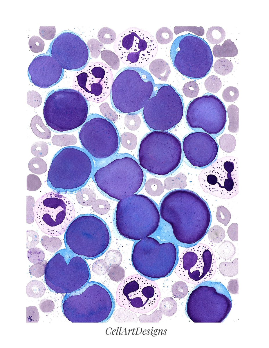 path_girl88's tweet image. ALL for #leukemiaawareness month. #pathology #pathart #pathx #pathtwitter