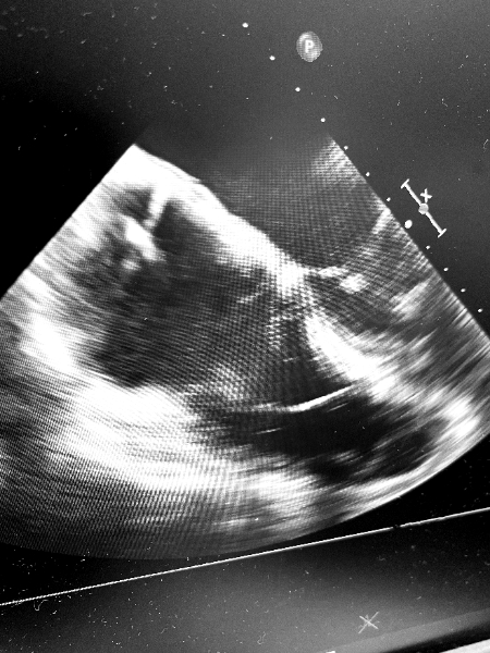 Cyrus Hadadi, MD tweet media