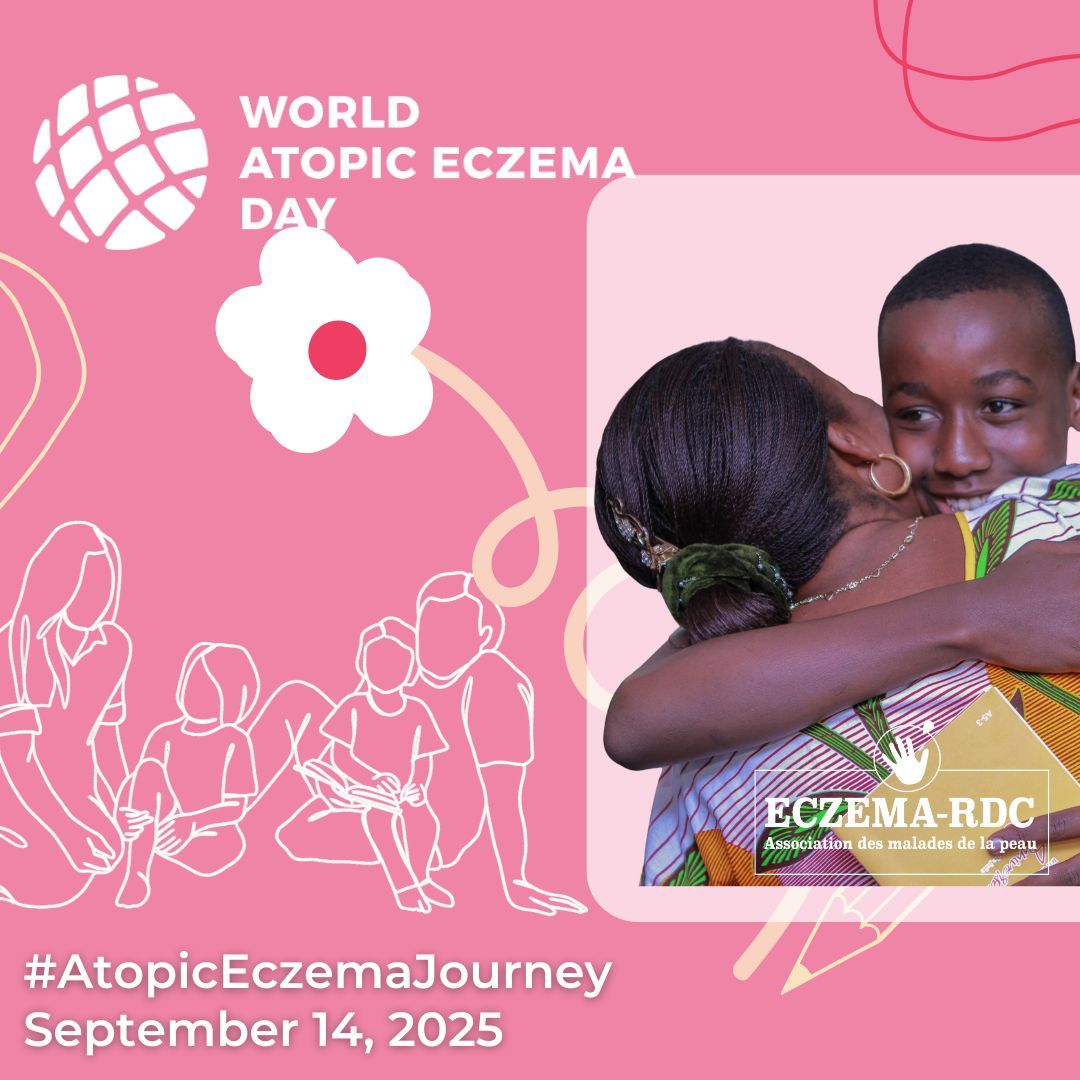 Eczema RDC (@rdceczema4128) on Twitter photo Séance pratique : astuces pour mieux vivre avec #eczéma et autres maladies de la #peau 
L’eczéma atopique et d’autres maladies de la peau n’affectent pas seulement le corps, mais aussi l’esprit. Le stress qu’elles provoquent peut aggraver les symptômes, créant un cercle vicieux Séance pratique : astuces pour mieux vivre avec #eczéma et autres maladies de la #peau 
L’eczéma atopique et d’autres maladies de la peau n’affectent pas seulement le corps, mais aussi l’esprit. Le stress qu’elles provoquent peut aggraver les symptômes, créant un cercle vicieux