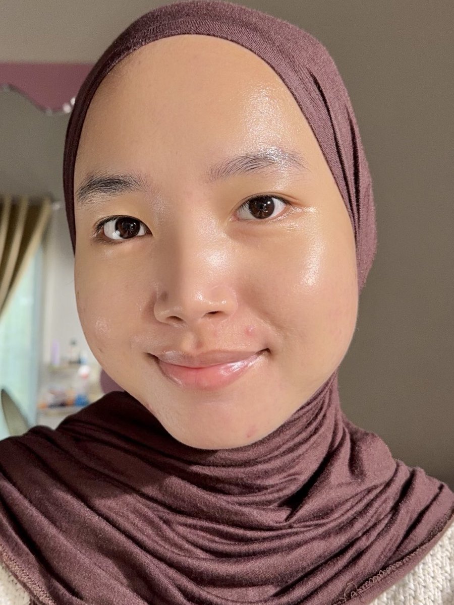 mau sharing sedikit pengalaman aku sebagai ACNE FIGHTER since 2019 - sampai sembuh

progressnya pelan pelan tapi pasti &amp; kulit aku sekarang udah jauh better banget 🥹👍🏻