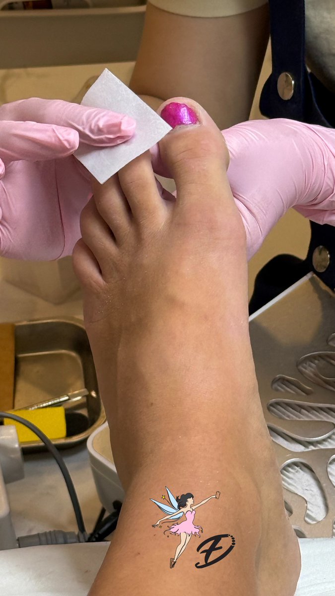 fairy_diary_com's tweet photo. Luna got some pedicure today 😍 wow, her feet are so sunkissed 🌞 #fairydiary #fairy #diary #feet #feetmodel #feetdiary #feetfetish #toes #pedicure #toenails #paintedtoenails #pinktoenails #freshnails #freshfeet #germanfeetdiary #feetfetish #fetish https://t.co/Hu9Qgjkry2