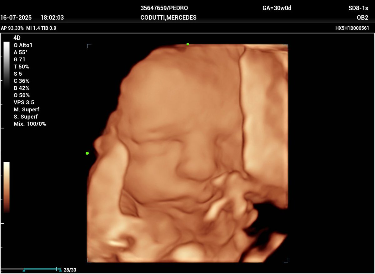 Y aunque duermo poco, sueño cada noche con vos 🤍🎶