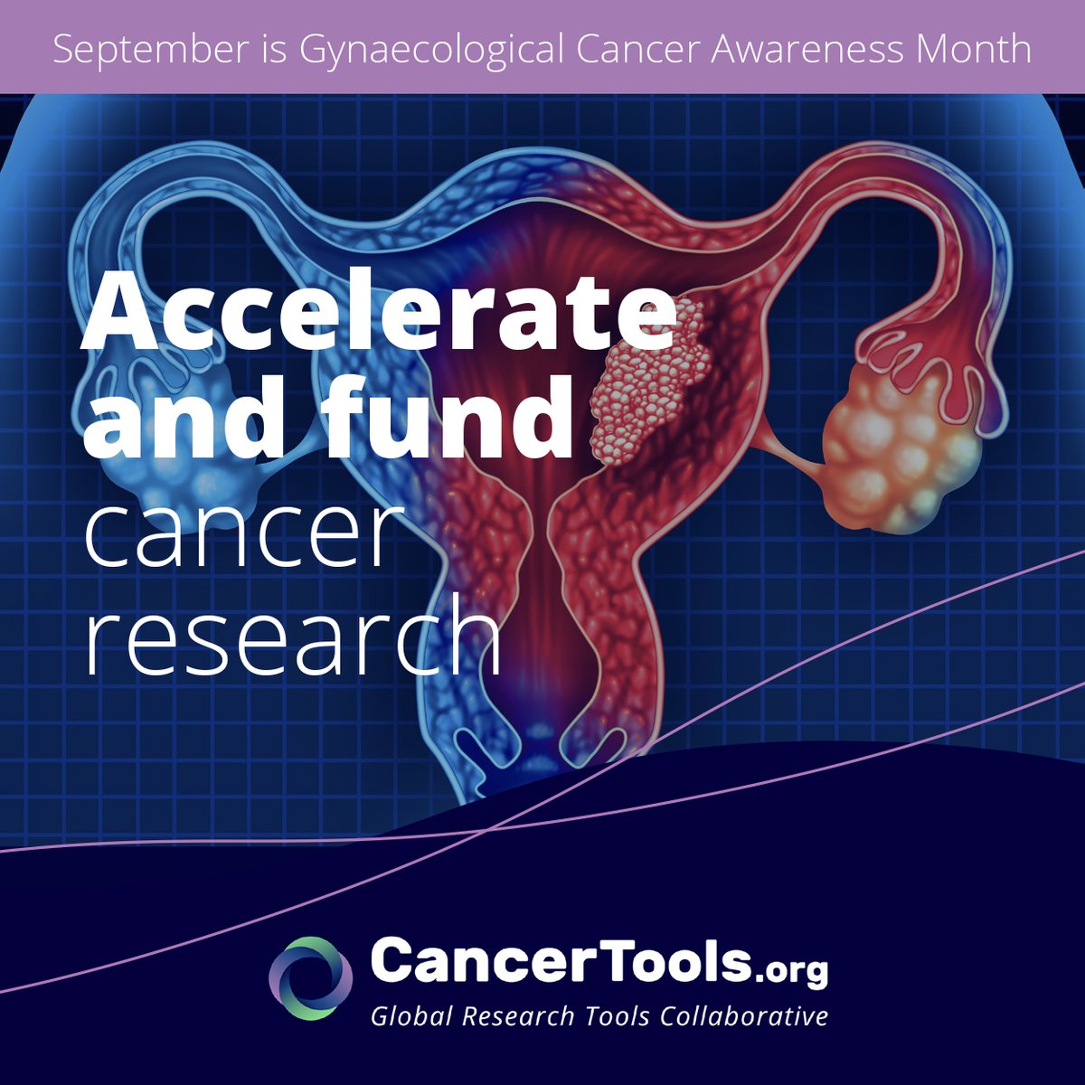 CancerToolsOrg's tweet image. Every tool we equip scientists helps researchers move closer to breakthroughs in ovarian &amp;amp; other gynae cancers.

From lab bench to real-world impact, we stand with @CR_UK &amp;amp; the global research community this #GynaecologicalCancerAwareness Month.

Explore our resources:…