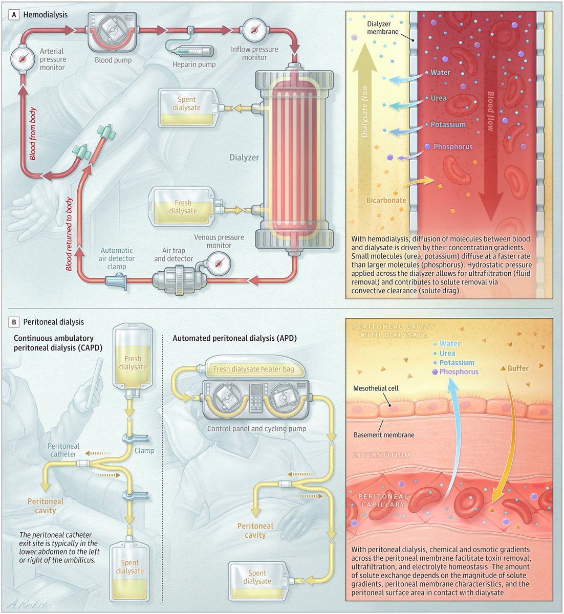 Muy buena imagen de las dos terapias de soporte renal en ERC. 
Para las diapositivas 👌🏻👌🏻
<a href="/JAMA_current/">JAMA</a>
