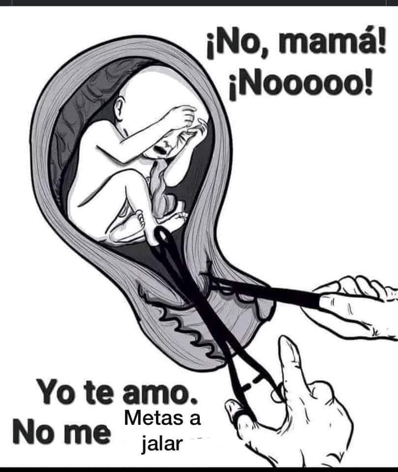 ¿Que no ves que me duele, mami? 😞