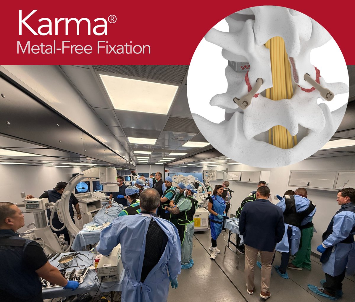 Thinking differently drives innovation in spine surgery. Surgeons at our Advisory Council experienced Karma®, a minimally-disruptive, metal-free, low-profile, low-artifact, and patient-centric solution for degenerative spondylolisthesis.
Learn more at bit.ly/3V9Sa9d.