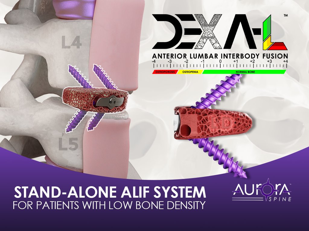 Trent J. Northcutt (@trentnorthcutt) on Twitter photo Here we GO!! #DEXA ALIF Stand Alone: 💚💛❤️💪 <a href="/AuroraSpine/">Aurora Spine™ | Purpose Driven</a> #PatientFirst 👈 #BoneDensityMatters Here we GO!! #DEXA ALIF Stand Alone: 💚💛❤️💪 <a href="/AuroraSpine/">Aurora Spine™ | Purpose Driven</a> #PatientFirst 👈 #BoneDensityMatters