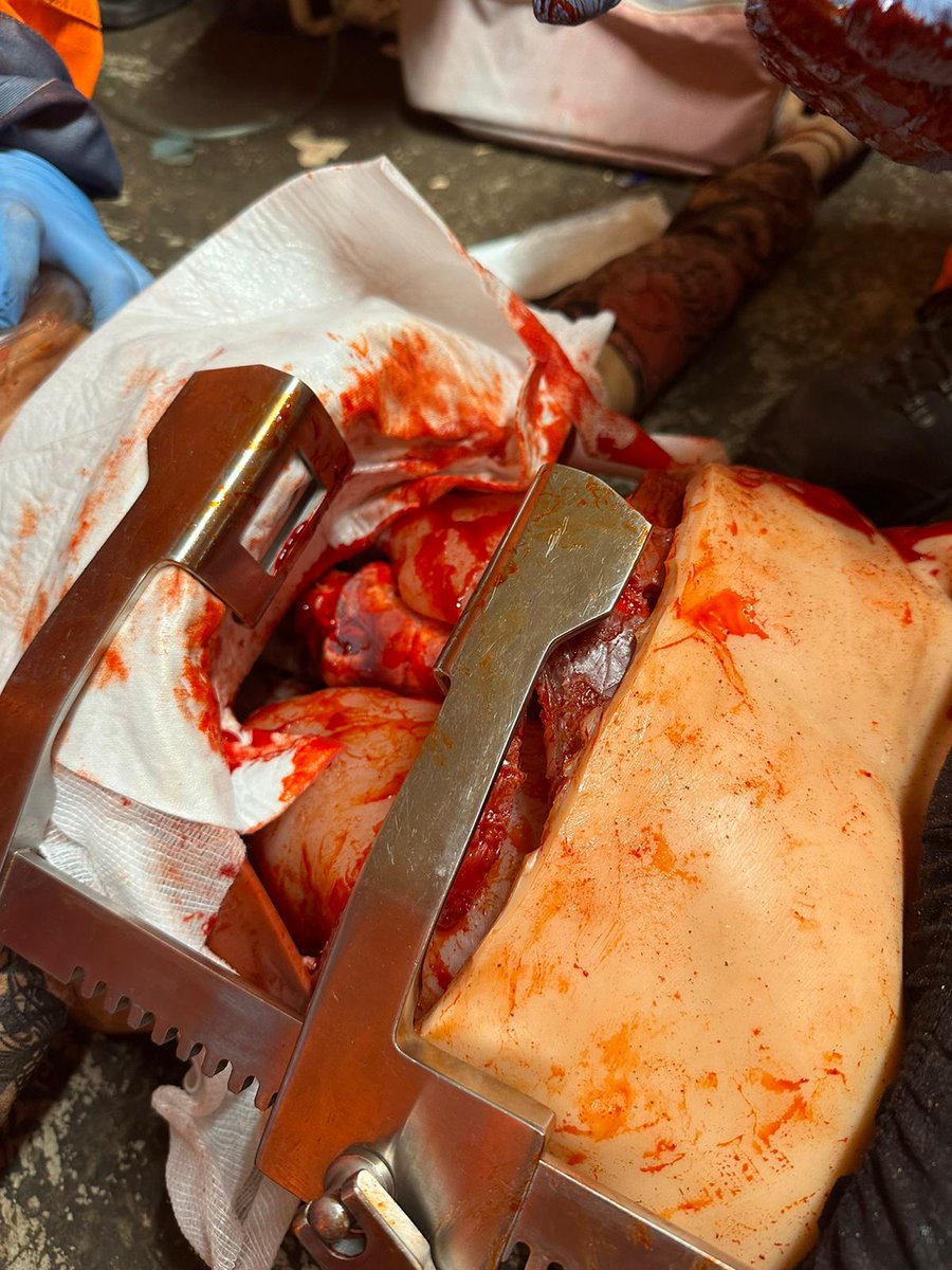 What an amazing course from <a href="/ATACCGroup/">The ATACC Group</a>! The most life-like simulations with amazing instructors, facilities and simulated patients. 
Thank you <a href="/GalenLtd/">Galen Ltd</a> and <a href="/ParamedicsUK/">College of Paramedics</a> for an amazing scholarship. Very proud to wear the Delta 7 badge.
Go team Orange! An incredible experience.