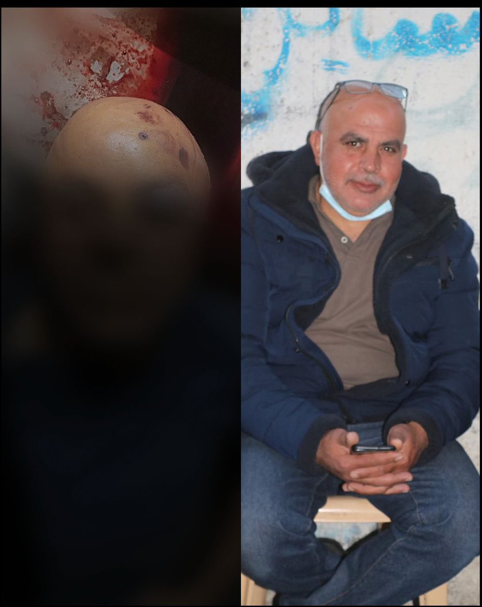 Today, Israel executed my uncle Kamal with a bullet to the head as he tried to get food. 
Earlier this year, it executed his son Osama, and before that, his son Sami was shot in the spine. 
Israel has killed half our extended family. The official death toll is far below reality.