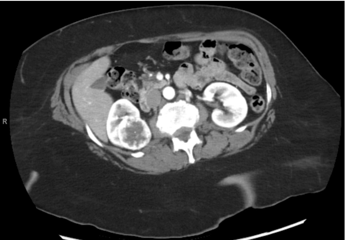 UroToday.com tweet media