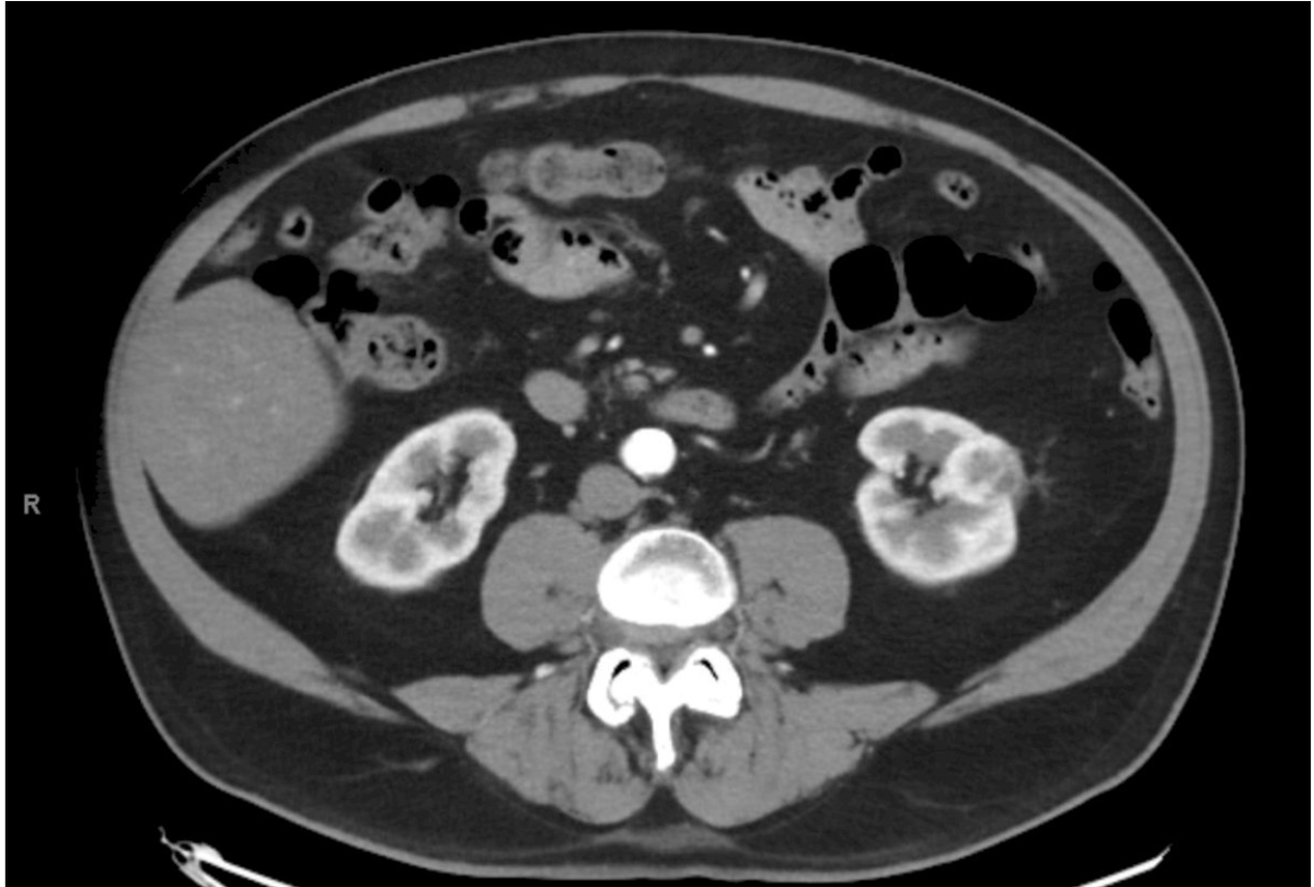 UroToday.com tweet media