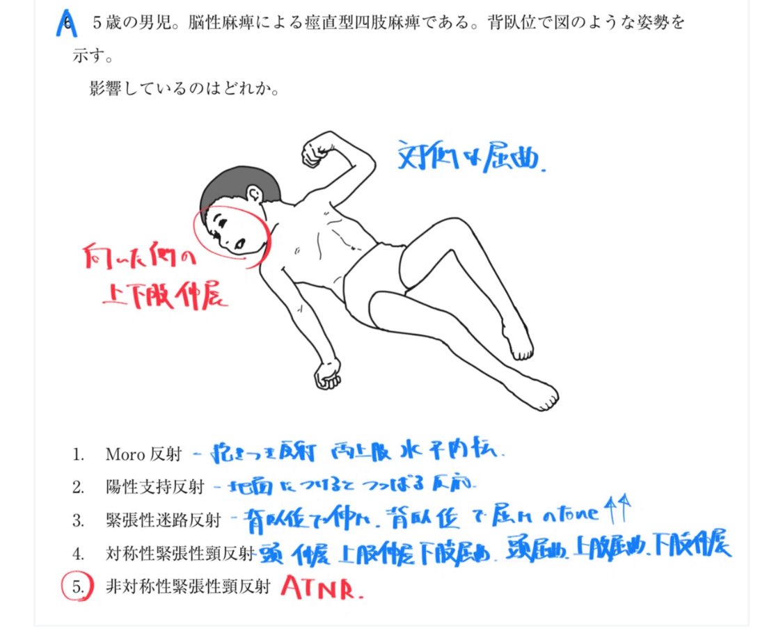 uruururinrin's tweet photo. 第60回理学療法士国家試験
#ネクストリハアカデミー https://t.co/ZdcbLyhB8z