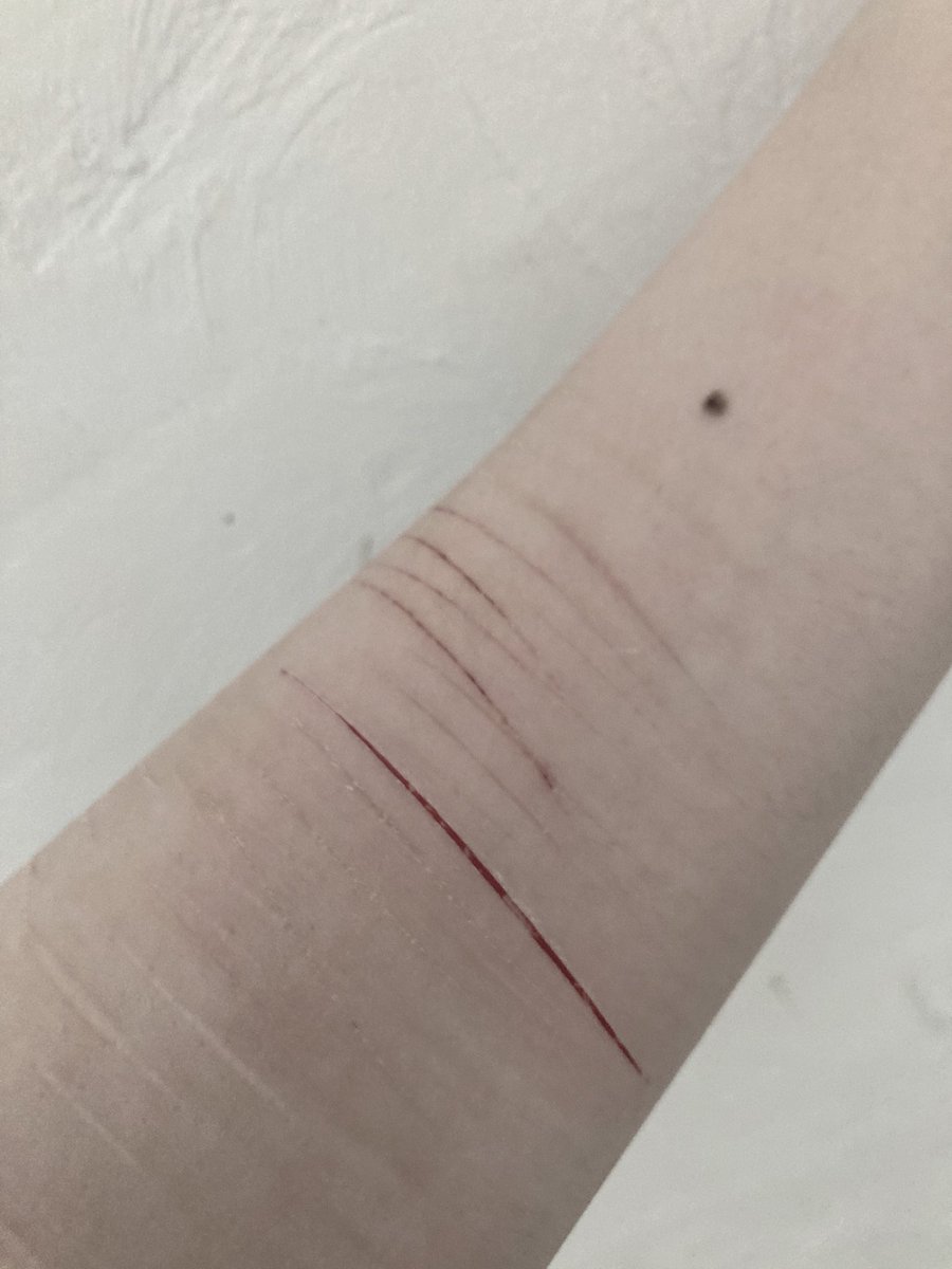 この後絆創膏がないことに気づいた