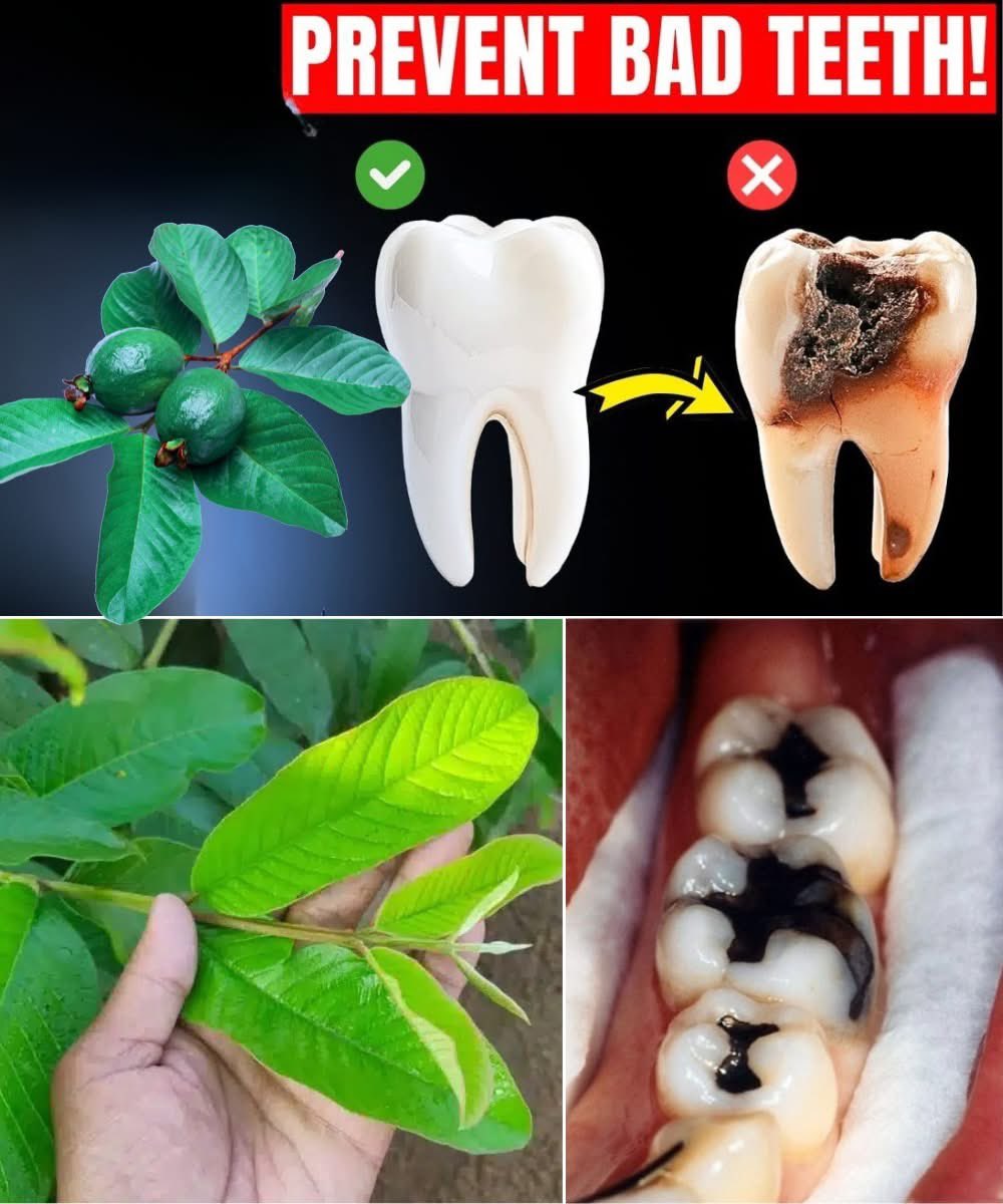 Top 3 ways to treat tooth decay with Guava leaves, simple and cost-effective🌿🦷

1. Mouth rinse: boil 6-7 fresh guava leaves in 1 cup water, cool and use twice daily.

2. Chew Raw Leaves: Chew 2-3 tender leaves after meals.

3. Paste: Grind 5 leaves mixed with a pinch of salt,