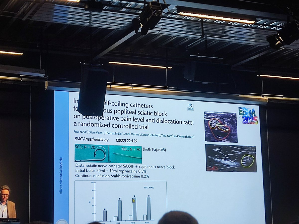 MadanNarayanan's tweet photo. Self-retaining and soft tip catheters reduced migration or displacement. #ESRA2025 https://t.co/7aZXrFw0pU