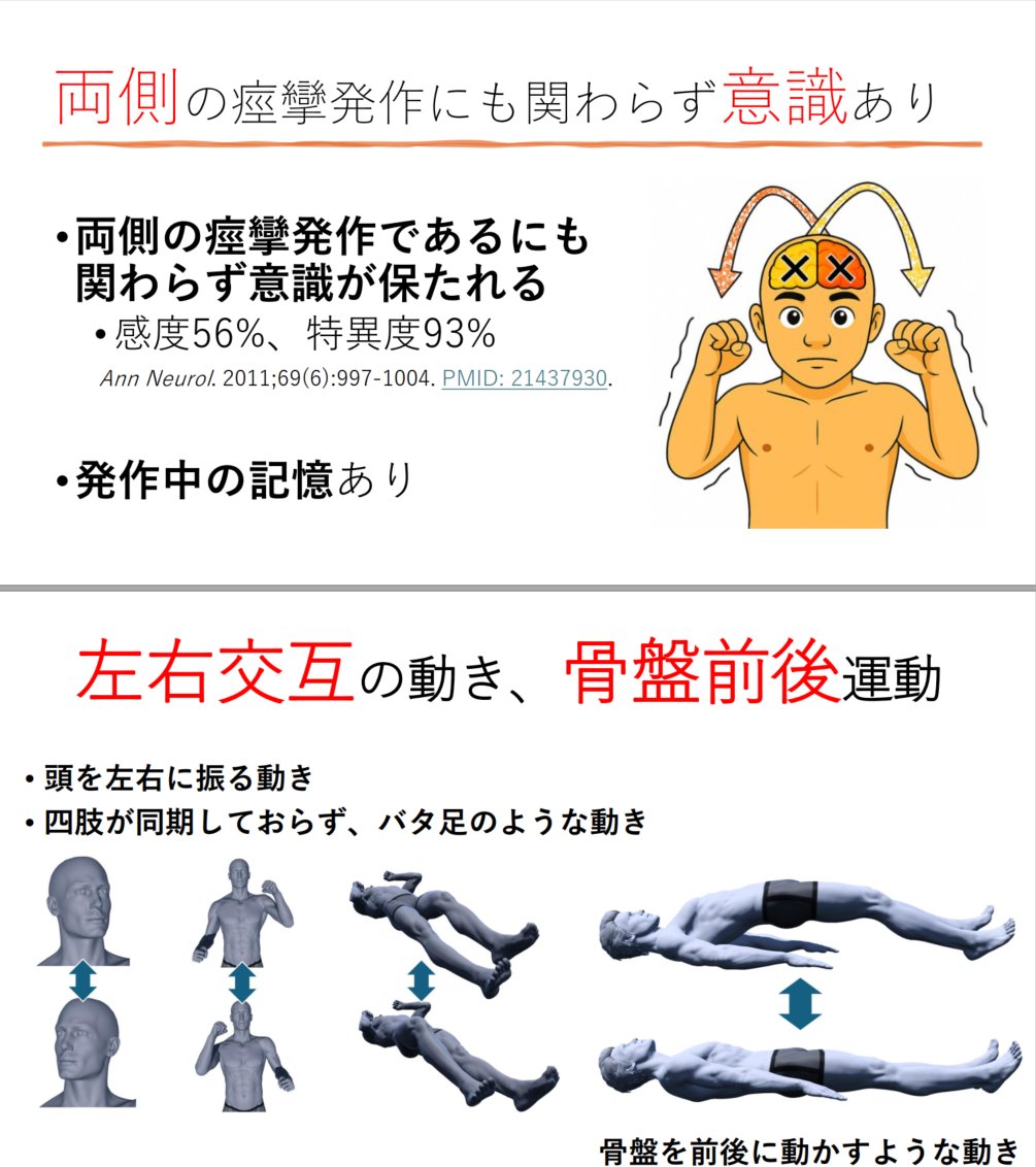 zCPAeok4TYzfLDA's tweet image. 精神科病院である陽和病院でPNESの講演しました。
ベッドサイドで診断するために必要な知識のエビデンスを話したのちに、8症例の動画で共に学びました。
次回は脱力の勉強会をするかも知れません。

#PNES #講演 #医学 #精神科 #丸太町病院 #総合診療