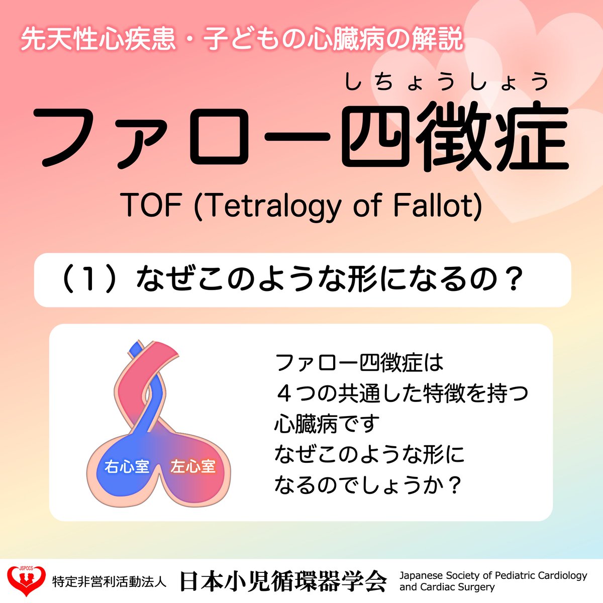 JSPCCS's tweet image. 【公式Instagramより】

＼ファロー四徴症／

４つの共通した特徴を持つ心臓病で、
チアノーゼ性心疾患の中では最も多い病気です。

なぜこのような形になるのでしょうか？？
それがわかれば４つの特徴が覚えやすくなるかも！

♡･････♡･････♡･････♡･････♡･････♡…