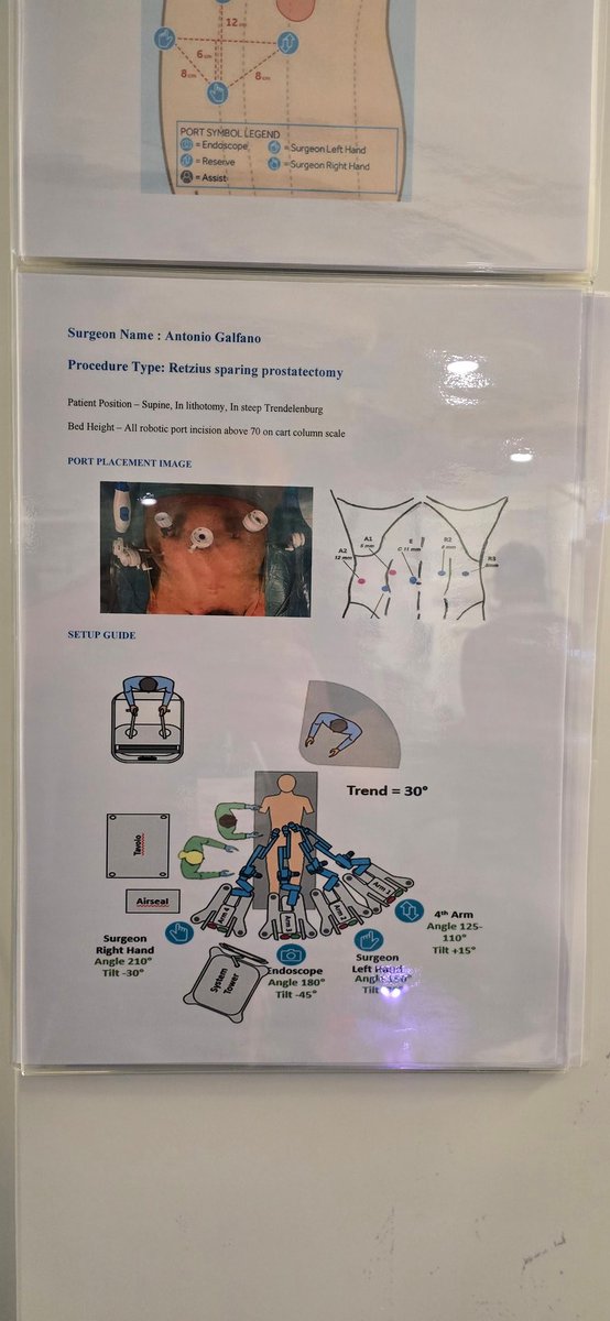 Final morning of #ERUS25, the sun is shining in anticipation of the first case of the day with <a href="/agalfano/">Antonio Galfano</a> at <a href="/GuysUrology/">Guy's Urology News</a> 

Plan is for a <a href="/Medtronic/">Medtronic</a> #HUGO #rsRARP 

Delightful portuguese gent with:
•GG2 6mm Rt anterior
•Borderline cT3a
•MUL 15mm
And fully aware of #LiveSurgery