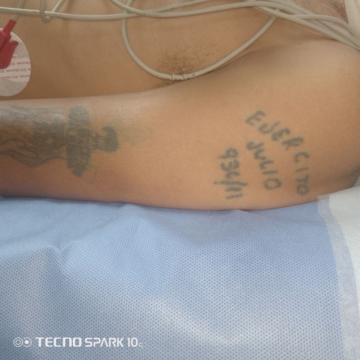 Un paciente se encuentra  en el Hospital Domingo Luciani de El Llanito, Caracas en el servicio de politrauma que fue arrollado el miércoles en horas de la noche.
No cuenta con ningún documento de identificación.
Tiene un tatuaje en el brazo izquierdo. 
Se solicita a familiares.