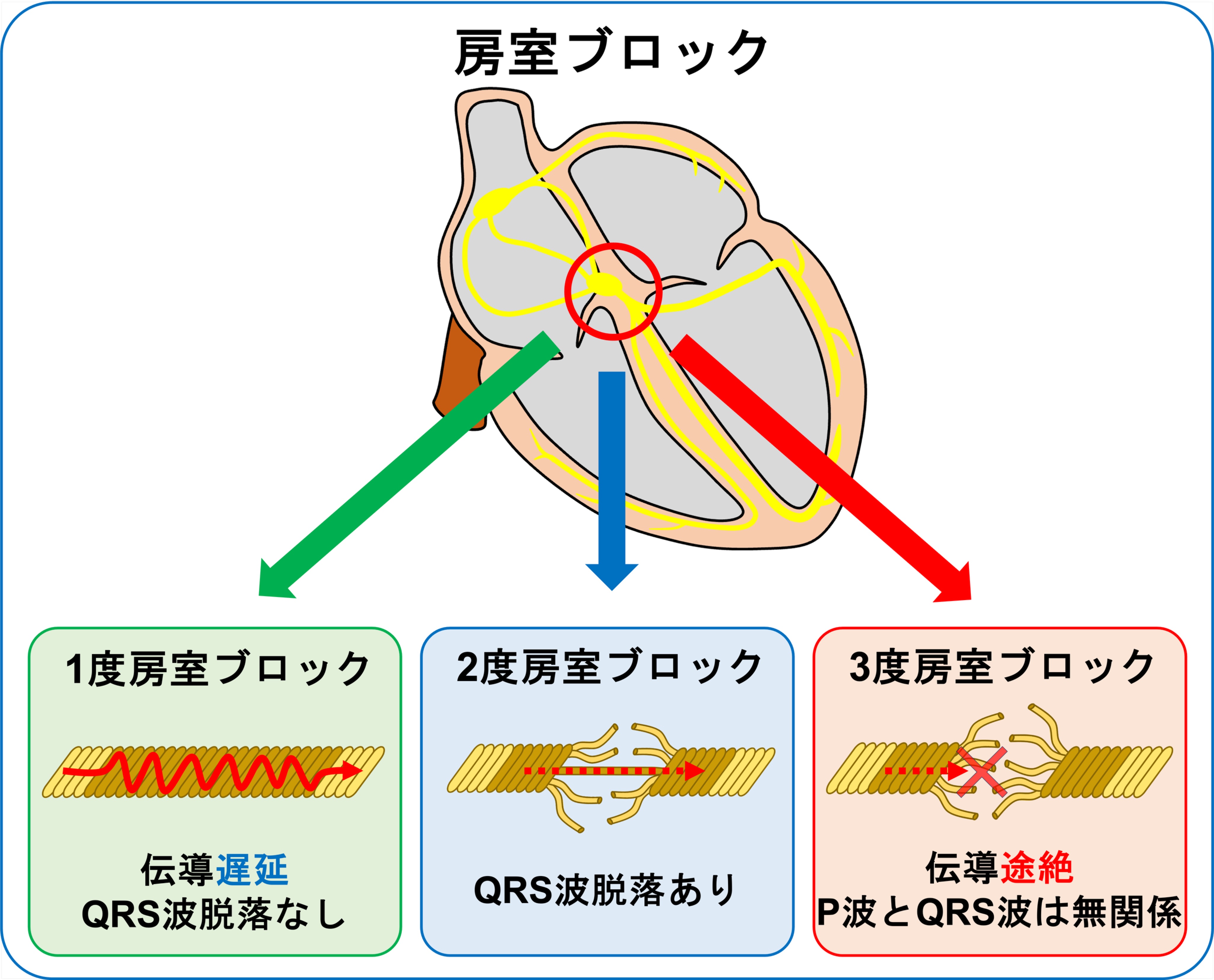 専門医のための循環器病学【裁断してません】 専門医のための循環器病学 | 書籍詳細 | 書籍 | 医学書院