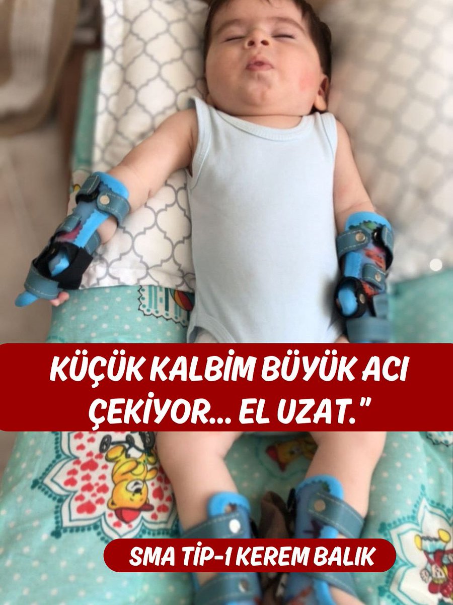 Keremin elleri oyuncak tutmalıydı, ayakları koşmalıydı Ama şuan korselerin içinde
Her gün bir nefes almak için, bir an daha güçlü kalabilmek için minicik bedeniyle büyük savaşlar veriyor Minicik elleriyle hayata tutunan Kereme hep birlikte güç olalım

•KEREM yaz 6523'e gönder ❤️