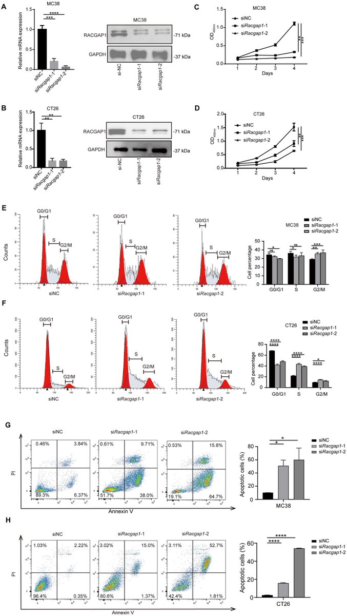 J_Immunol's tweet image. Colorectal #cancer (CRC) progression is associated with the evolution of the tumor microenvironment. New data identified RACGAP1 as a potential biomarker and immunotherapeutic target for its role in the #CRC microenvironment. Find this #TopRead here: ow.ly/BMqX50WV7sK.