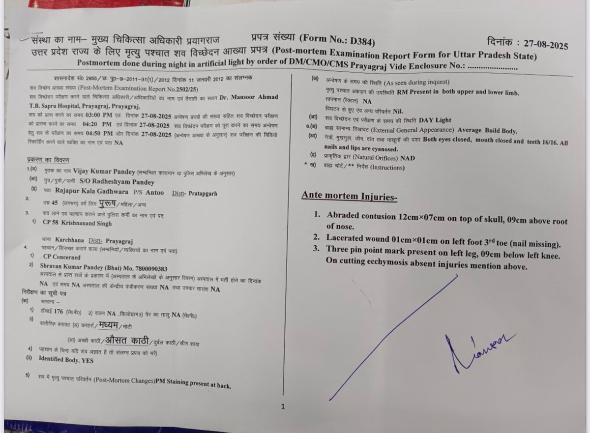 UPTimes72's tweet photo. @DCPYNagarPrj @pratapgarhpol @ADGZonPrayagraj @prayagraj_pol @igrangealld PM रिपोर्ट में साफ़ दिख रहा युवक के सर पर गंभीर चोटें आईं हैं https://t.co/D8UQLRmrp9