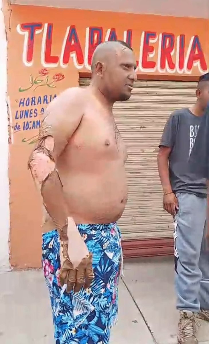 DimeChavez's tweet photo. Tu ayuda sería muy útil para la recaudación de fondos en GoFundMe. Comparte, apoya o dona. Cada pequeña acción cuenta. https://t.co/Qy12azOlEH https://t.co/KaBhiyiHRG