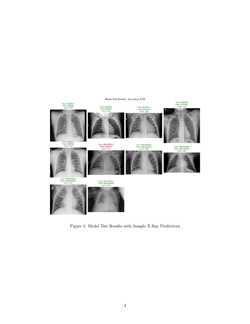 thetommyk_'s tweet photo. Excited to share my pneumonia detection project using a CNN to classify chest X-rays with 90% accuracy! Built with TensorFlow, it uses data augmentation and class weights to handle imbalanced data. #DeepLearning #MedicalAI #ArtificialIntelligence https://t.co/YbWQ94jCOm