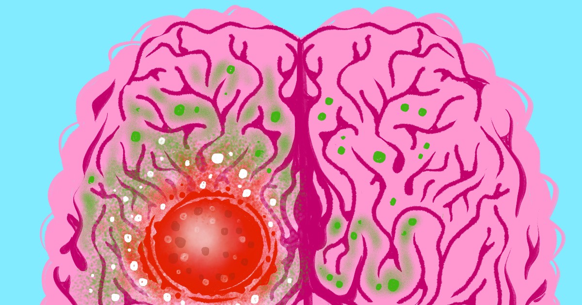 UMich Rad Onc tweet media