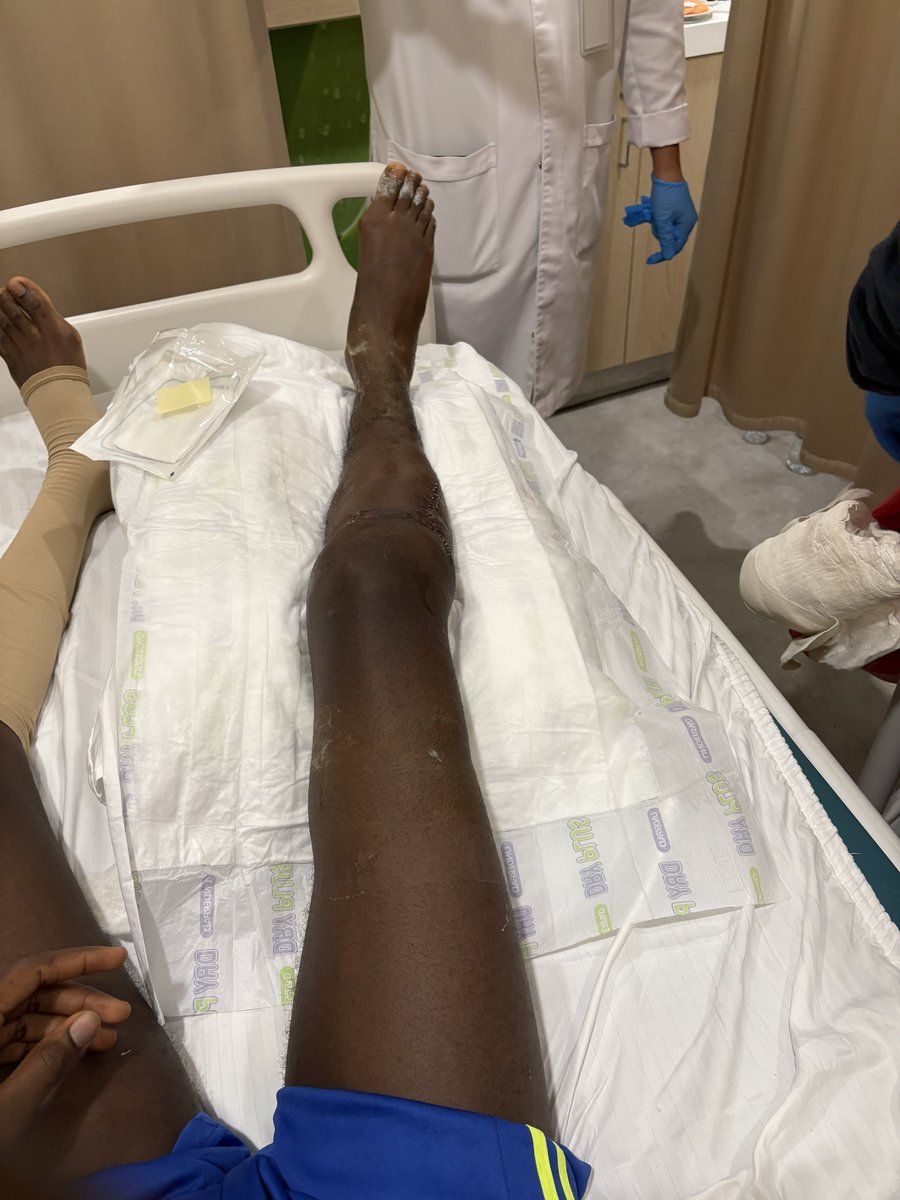 _belikebaddy's tweet image. I just woke up because I got knocked out (sedated because of pain) after I had my dressing changed. I was bleeding a little after the surgery (which is totally normal btw) but I’m a lil better now❤️.